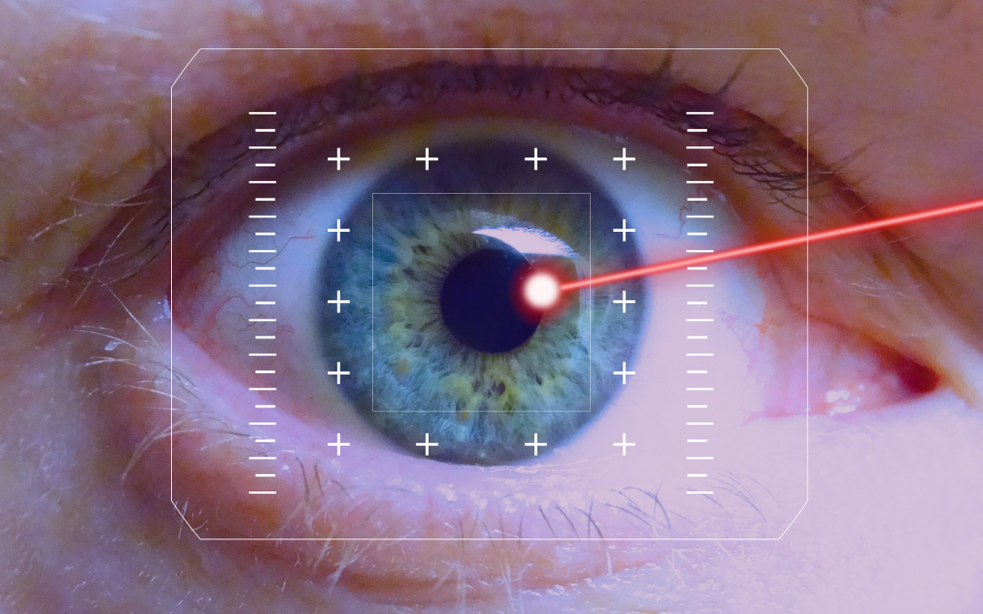 Is Refractive Surgery an Option for You?