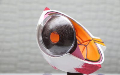 What is a Posterior Vitreous Detachment (PVD)?