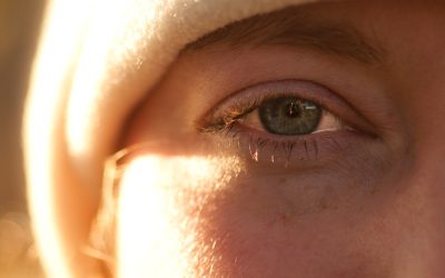 Why are Light Eyes More Sensitive to the Sun?