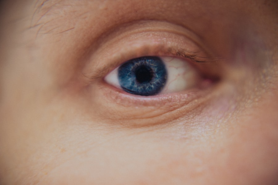 Photo Pediatric Eye Exams