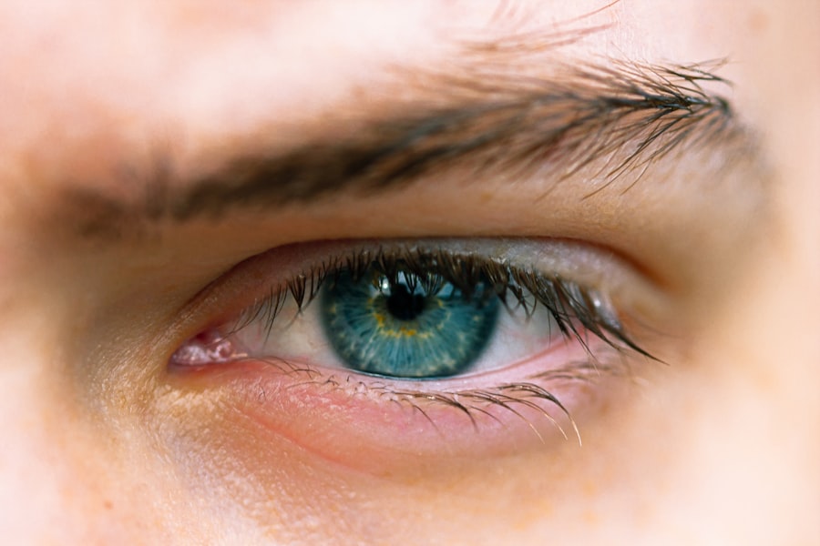 Contact Lens Care Mistakes