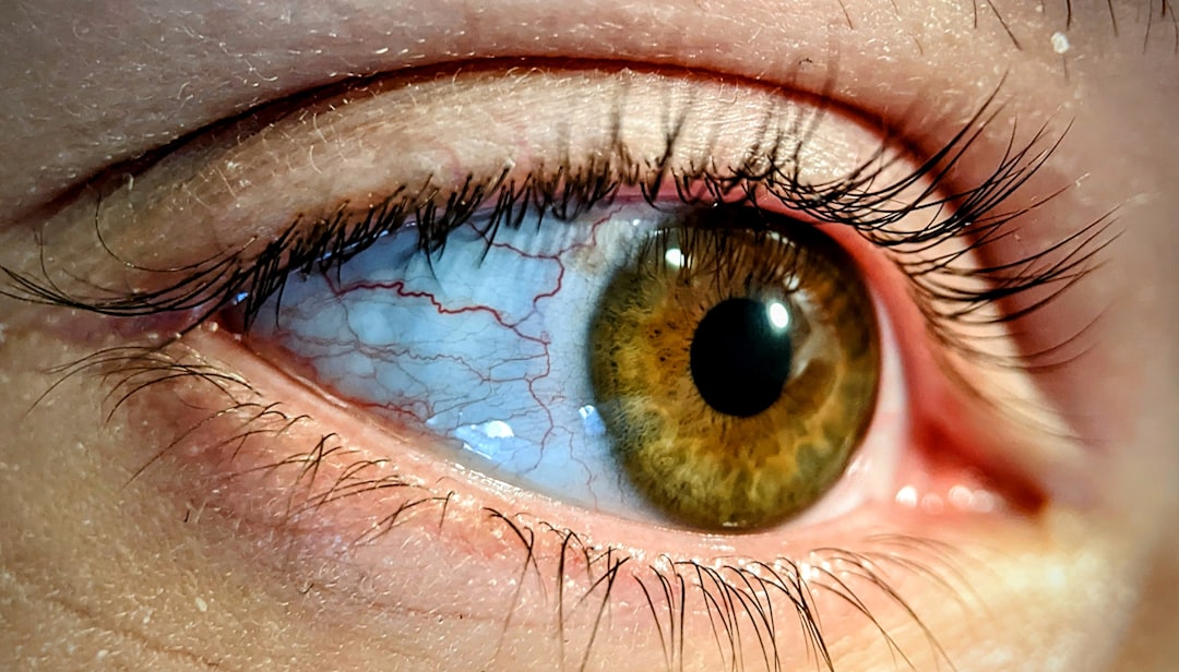 Contact Lens Care Mistakes to Avoid