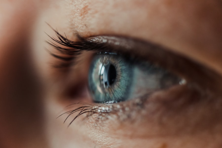 Photo Contact Lens Care Mistakes