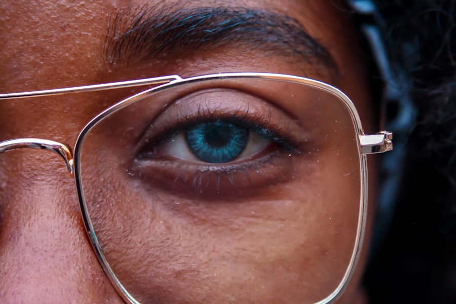Digital Eye Strain