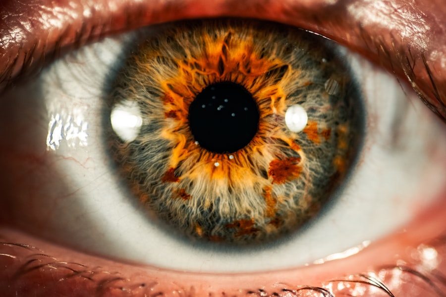 Diabetes Eyes