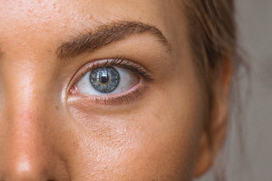 Photo Diabetes Eyes