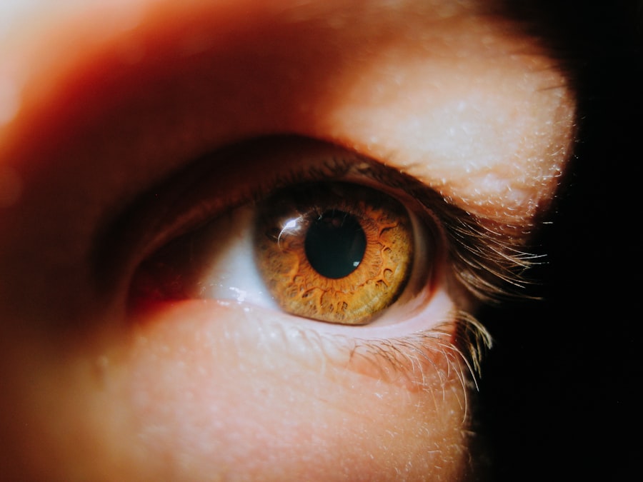 Photo Digital Eye Strain
